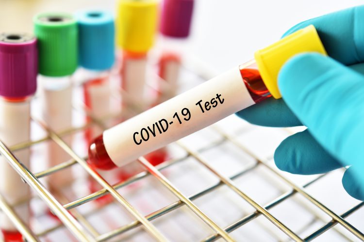 blood vial with 'COVID-19 test' written on it