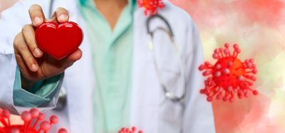 Doctor hold red heart with concept model covid 19 or coronavirus case of respiratory epidemic or damage the lungs on watercolor tone background