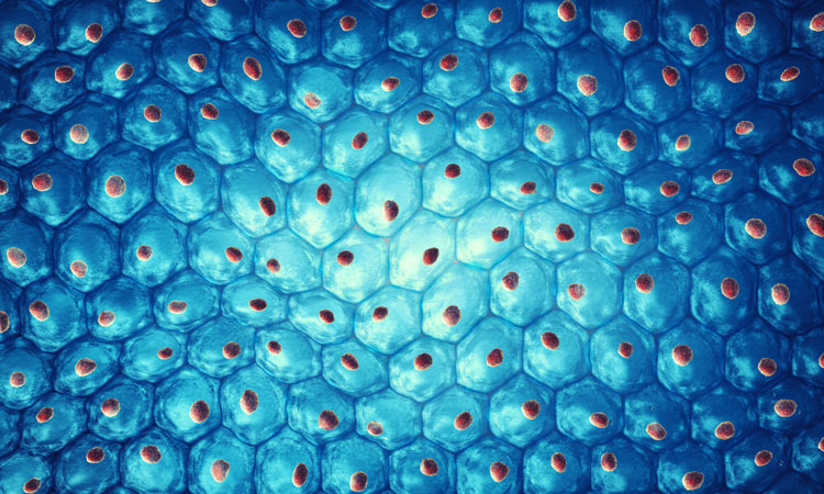 Development by design methodology: the key to successful manufacturing of patient-specific cell therapies