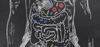 Digestive tract drawn on a chalk board in white with various colours and shapes of microbes