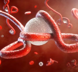 ebola