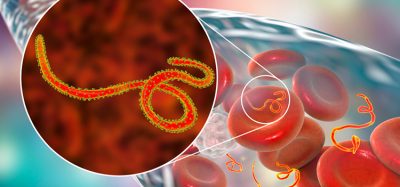 Ebola virus