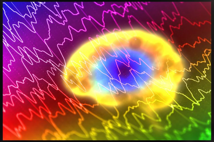 epileptic siezure brain waves overlaid on brain