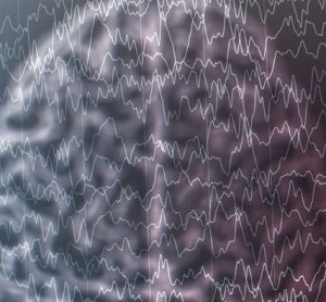epilepsy