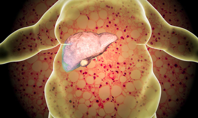 GABA possible treatment avenue of type 2 diabetes