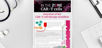 Infographic: Overview of the CAR-T cell therapy workflow