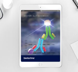 Handbook: Western blot