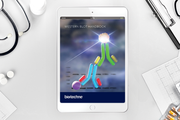 Handbook: Western blot