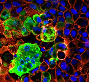 Image-based, quantitative approaches to study SARS-CoV-2 cell entry and infection: looking for the Achilles’ heel of virus infection