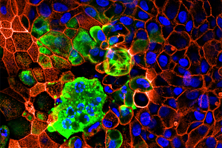 Image-based, quantitative approaches to study SARS-CoV-2 cell entry and infection: looking for the Achilles’ heel of virus infection