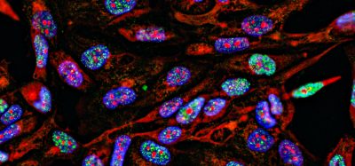 Fluorescent cell imaging