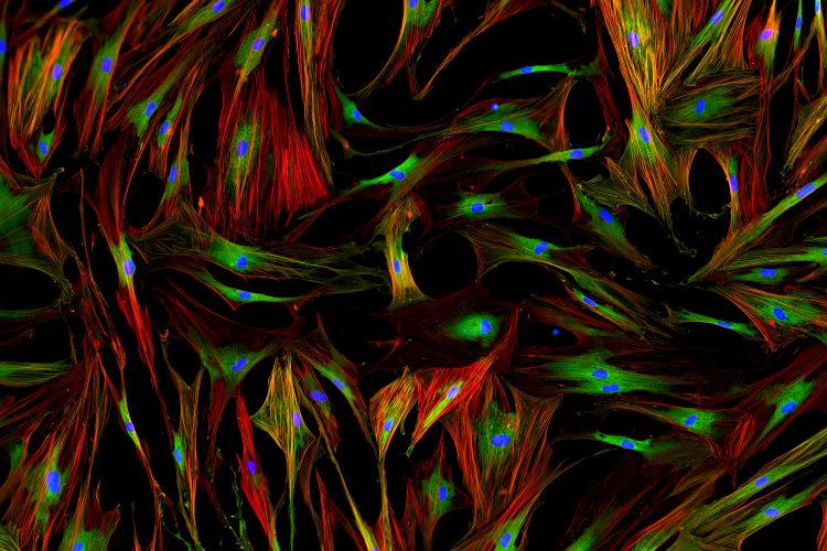 fluorescent microscopy of human fibroblasts with nuclei in blue, cytoplasm in green and cell membrane structures in red