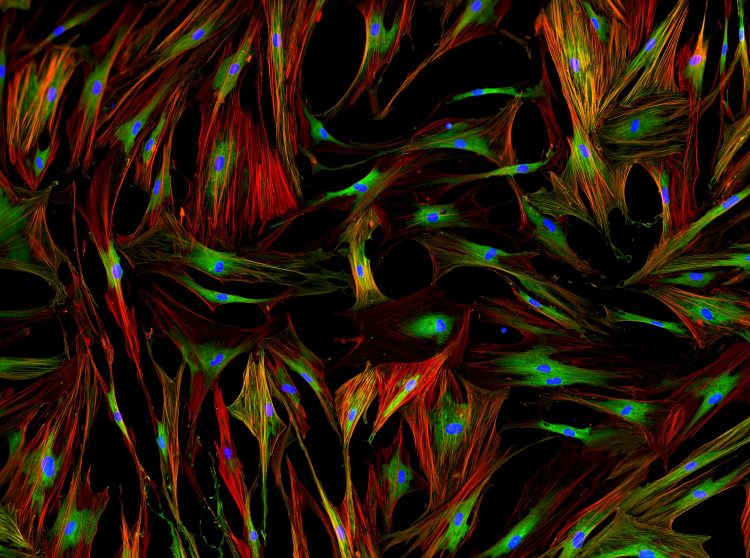 fluorescent microscopy of human fibroblasts with nuclei in blue, cytoplasm in green and cell membrane structures in red