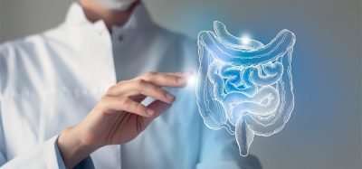 Female doctor holding virtual Intestine in hand. Handrawn human organ, blurred photo, raw photo colors. Healthcare hospital service concept stock photo