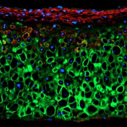 Chondrogenesis of iPSC micromasses