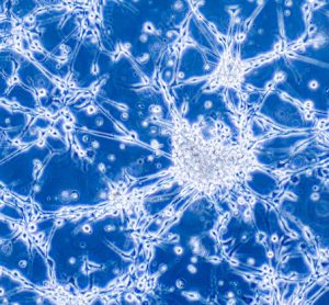 The role of ‘extra’ DNA in cancer evolution and therapy resistance