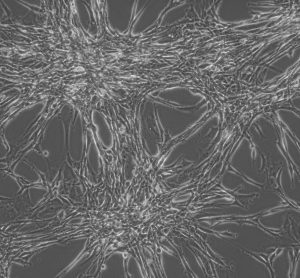 Glioblastoma Multiforme (GBM) cells in culture [Credit: Dr Jin-Min Nam].