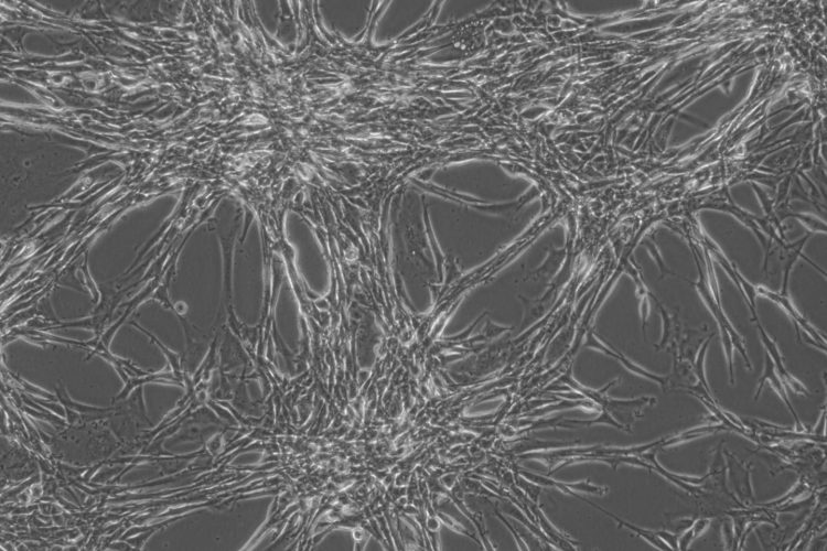 Glioblastoma Multiforme (GBM) cells in culture [Credit: Dr Jin-Min Nam].