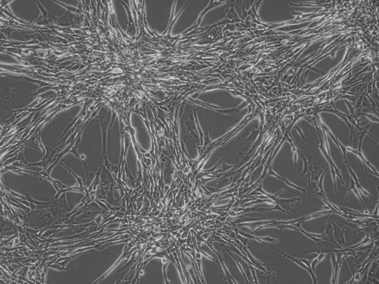 Glioblastoma Multiforme (GBM) cells in culture [Credit: Dr Jin-Min Nam].