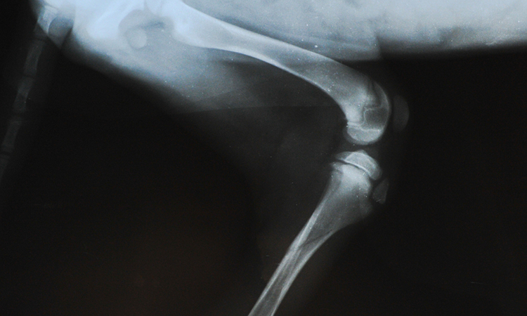 growth plate fractures