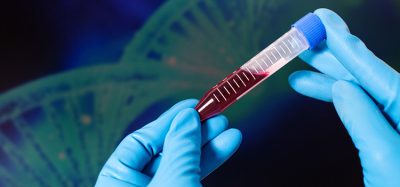 haemophilia