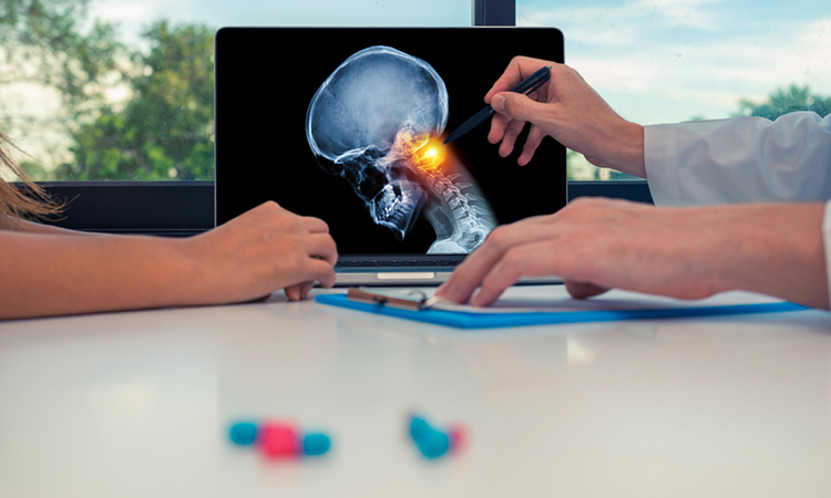 Doctor showing a x-ray of skull with pain in top of the neck on a laptop to a patient. Headache migraine concept