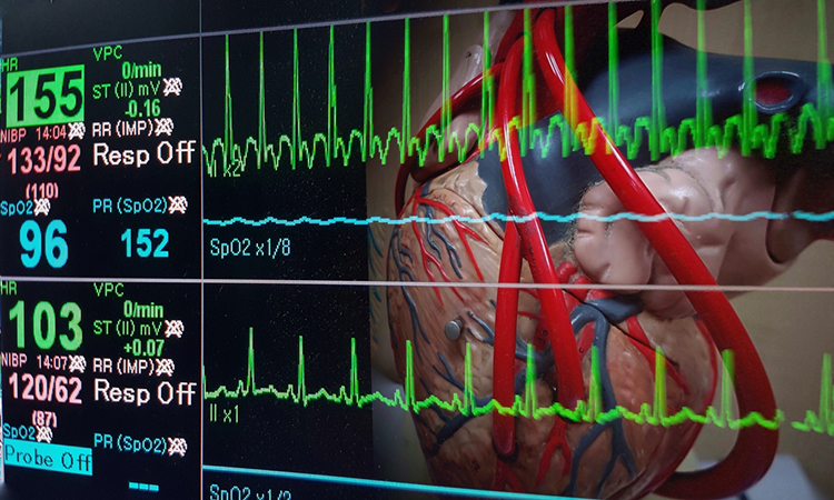 Heart and vital sign EKG monitor.