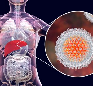 close up of a hepatitis C virus in a cutaway from a human liver