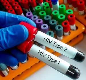 Scientist hold two test tube with blood sample for HIV type 1 and HIV type 2 antibody testing, hiv screening test