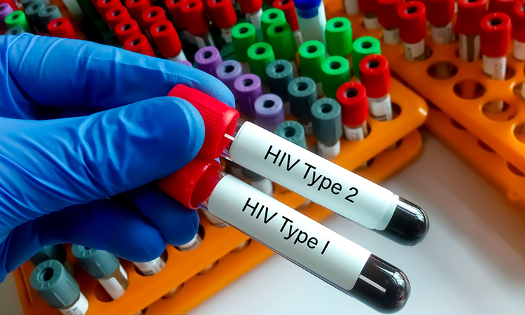 Scientist hold two test tube with blood sample for HIV type 1 and HIV type 2 antibody testing, hiv screening test