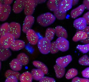 First 'haploid' human stem cells could change the face of medical research