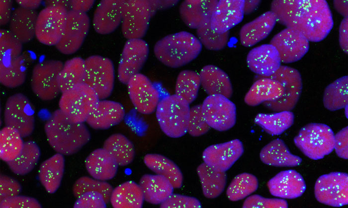 First 'haploid' human stem cells could change the face of medical research