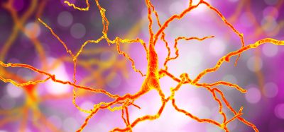 3D rendering of dopaminergic neuron