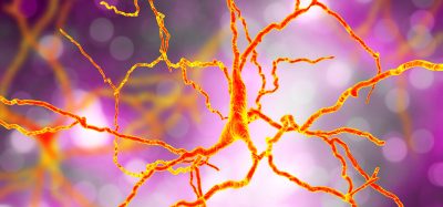 3D rendering of dopaminergic neuron