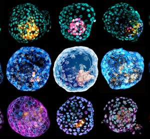 iBlastoids
