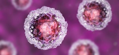 iPSCs