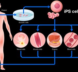 Image showing diagram of induced pluripotent stem cells