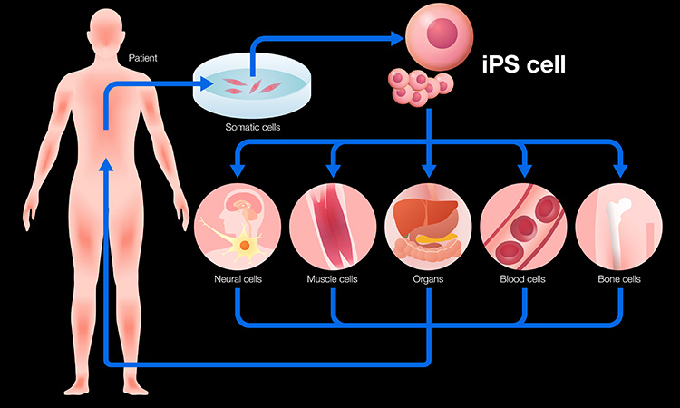 Image showing diagram of induced pluripotent stem cells