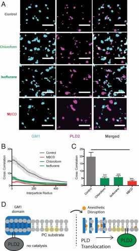 Inhaled anesthetics displace PLD2 from GM1 rafts. (A) Representative super-resolution (dSTORM) images of fluorescently labeled CTxB (lipid raft) and PLD2 before treatment (control) and after treatment with chloroform (1 mM), isoflurane (1 mM), and MβCD (100 µM) in N2A cells (Scale bars, 0.5 µm.) (B) Average cross-correlation functions [C(r)] showing a decrease in PLD2 association with ordered GM1 rafts after treatment with anesthetic or MβCD. (C) Comparison of the first data point in B (5-nm radius) (±SEM, n = 10 to 17) (Student’s t test results: ***P ≤ 0.001). (D) Schematic representation of PLD2 in GM1 rafts before (Left) and after (Right) anesthetic treatment. Palmitoylation drives PLD2 into GM1 rafts (blue rectangle) away from its unsaturated PC substrate (yellow circle). Anesthetics (orange hexagon) disrupts GM1 rafts causing the enzyme to translocate where it finds its substrate PC in the disordered region of the cell [Credit: Pavel et al.].