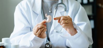 Female doctor holding Intestine in hand on right side.Healthcare hospital service concept stock photo. in background