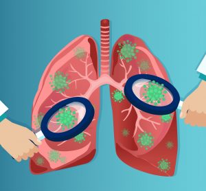 cartoon of magnifying glasses over covid-19 particles in lungs