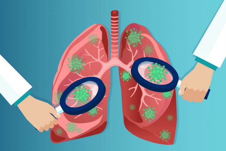 cartoon of magnifying glasses over covid-19 particles in lungs