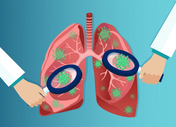 cartoon of magnifying glasses over covid-19 particles in lungs