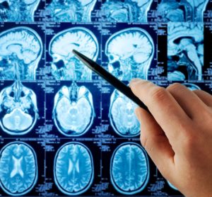 Research suggests ion channel blocking drugs could be used in cancer therapy