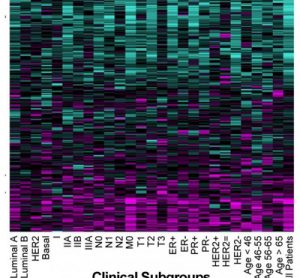 SURVIV analysis of breast cancer isoforms