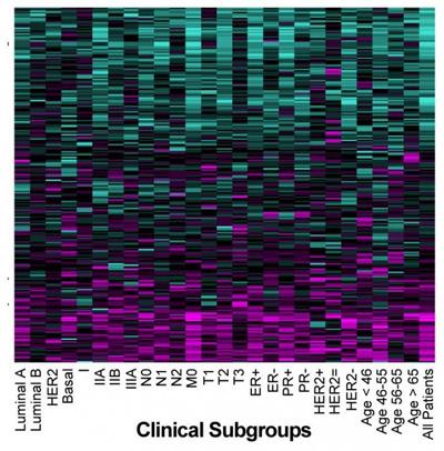 SURVIV analysis of breast cancer isoforms