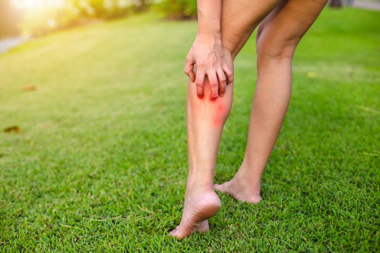 woman scratching the back of her leg while walking on grass - idea of allergic reaction itching