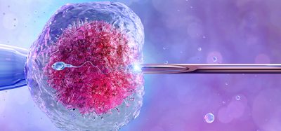 Human artificial insemination, in vitro fertilization, reproduction. Female egg cell, needle puncture the cell membrane, cell injection, sperm, ovum, zygote. IVF fertility treatment medicine, 3D image