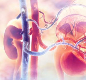 kidney injury