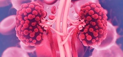 DNA sequencing for kidney disease